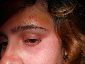 Tentativă de viol asupra unei tinere de 19 ani