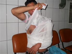 Tânăr rupt în bătaie de un grup de romi. S-a ales cu clavicula ruptă şi capul cusut în trei locuri
