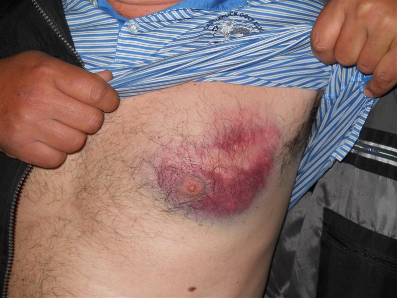 Meci de golf terminat cu bătaie. Proprietarul terenului a fugit după ce a fost ameninţat cu cuţitul