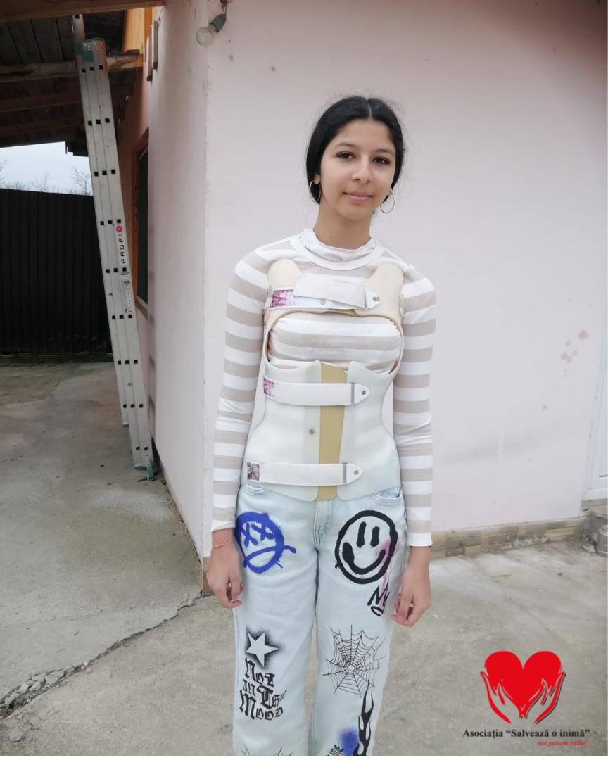&bdquo;Fiecare zi &icirc;mi curbează coloana tot mai mult&rdquo;. Erika, o adolescentă de 15 ani, are nevoie urgent de o operație pentru a putea trăi fără durere