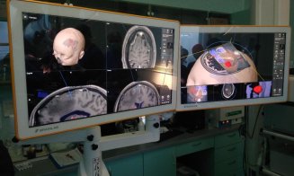 Operații cu un nou sistem de neuronavigaţie, la UPU Cluj
