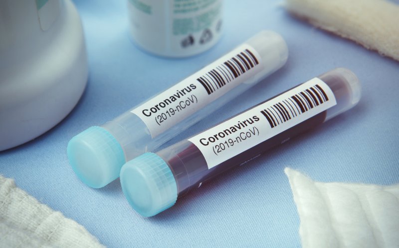 Încă un român infectat cu coronavirus