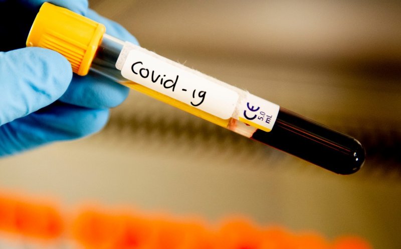 1.365 de cazuri noi de COVID-19 în ultimele 24 de ore şi 32 de decese