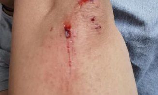 Mamă și copil pe bicicletă, loviți de un livrator: "Era cu ochii în telefon"