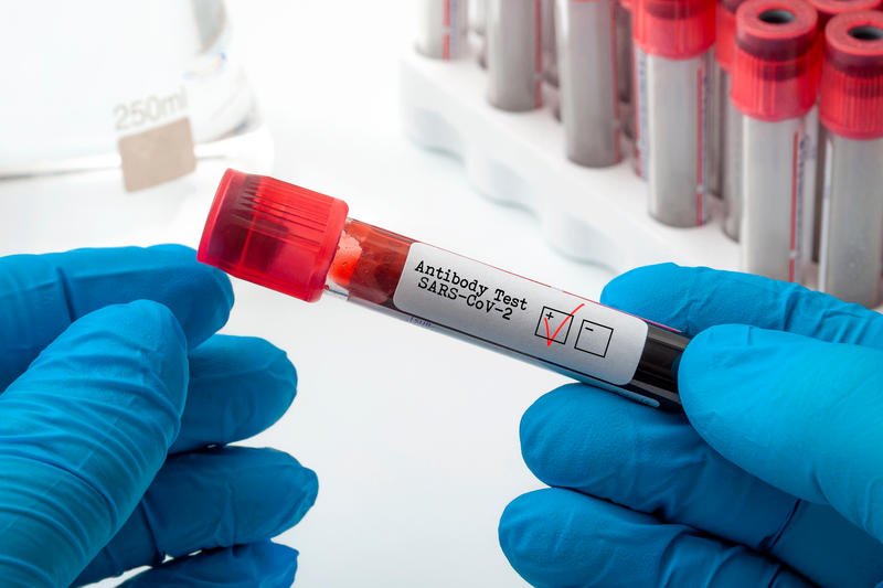Anticorpii durează până la 12 luni după infectare şi cresc după vaccinare