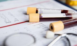 CNAS: Cei peste 40 de ani pot beneficia de analizele preventive chiar dacă nu mai există fonduri