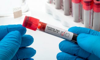 Imunolog: Testul de anticorpi după vaccinare, irelevant