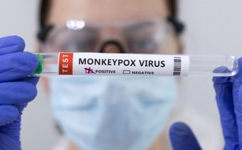 România va primi 5.000 de doze de vaccin împotriva variolei maimuţei/ Două cazuri noi, în ultima săptămână