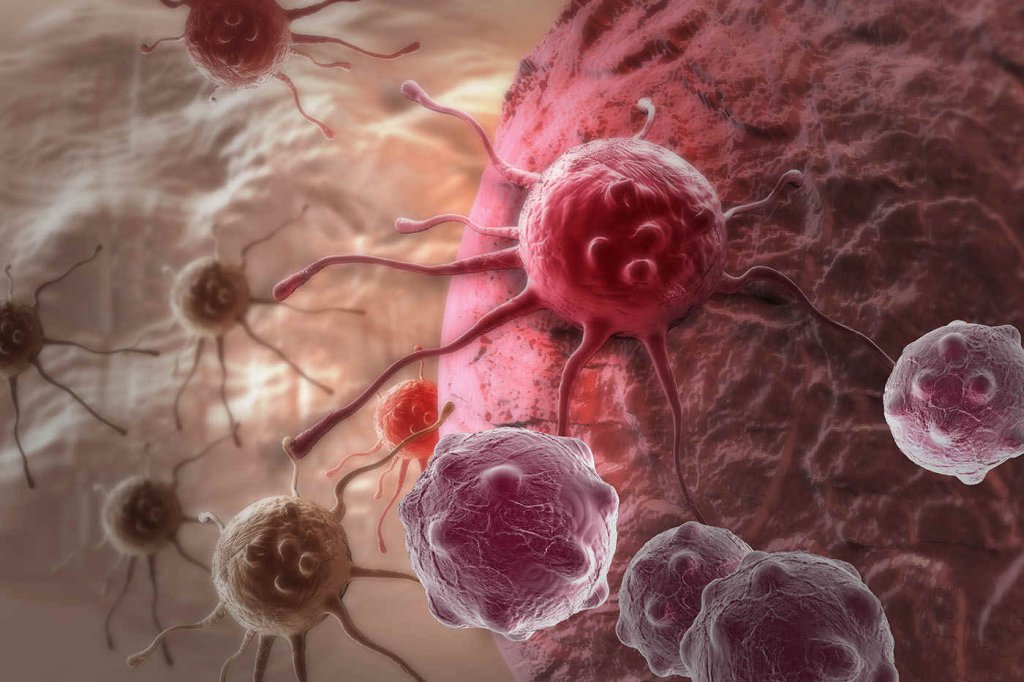 Experți: Europa se îndreaptă către o "epidemie de cancer"