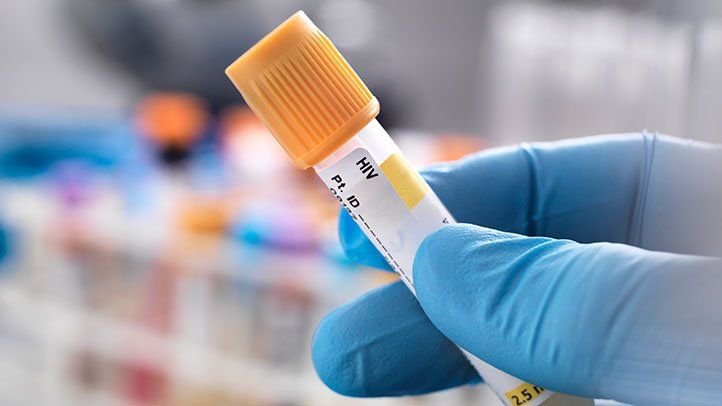 Ultimele zile ale campaniei ARAS. Testare gratuită şi anonimă pentru HIV şi hepatită C