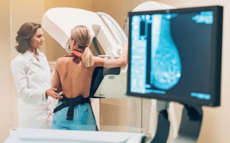 Noi recomandări în SUA privind mamografiile. De la ce vârstă ar trebui începute examinările