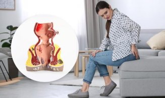 Probleme cu hemoroizii: cauze, prevenire și soluții de tratament