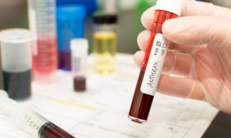 Alertă de ANTRAX! Trei bărbați, internați cu suspiciune de infecție. Unul a fost operat de urgență
