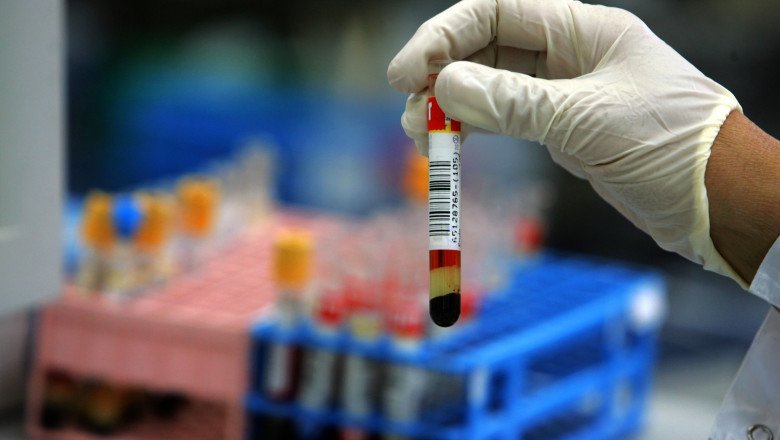 Un test de sânge poate detecta cancerul mai devreme la persoanele care au risc în familie