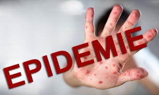 Ministerul Sănătății a declarat EPIDEMIE de rujeolă în România. Clujul, în topul îmbolnăvirilor