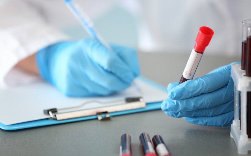 A fost descoperită o genă care poate creşte riscul unui tip de cancer