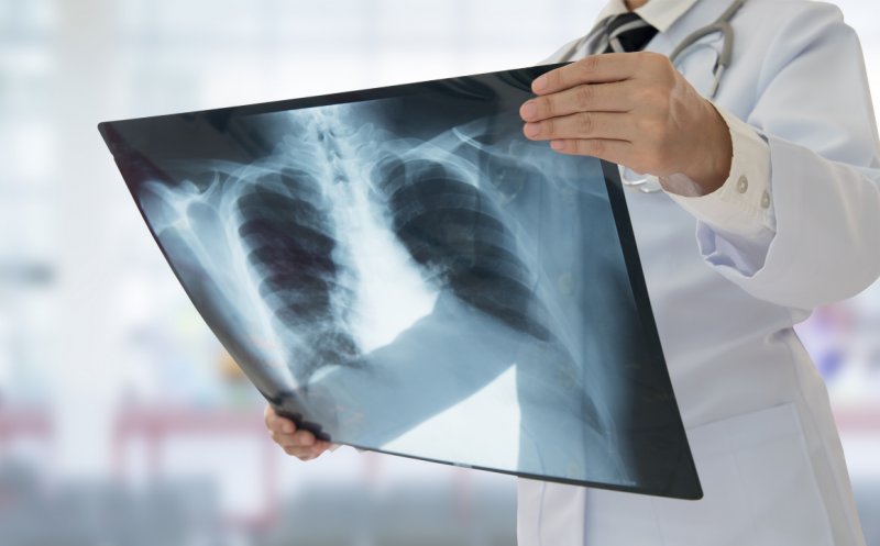 Medicii au descoperit un nou sindrom legat de Covid