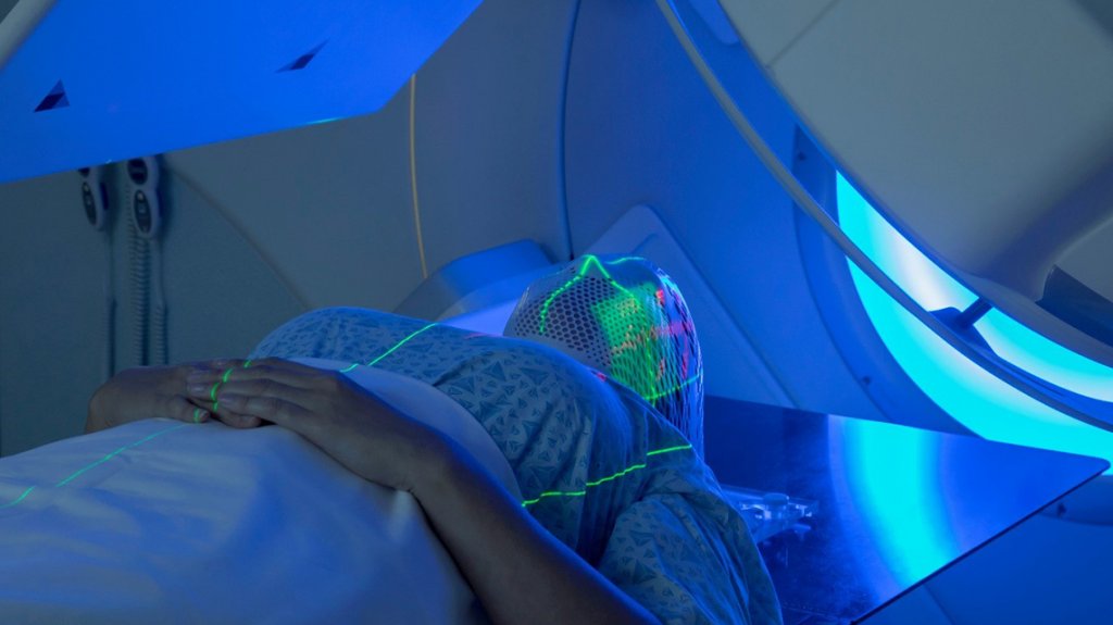 Toate tipurile de servicii de radioterapie pentru pacienţii oncologici vor fi decontate
