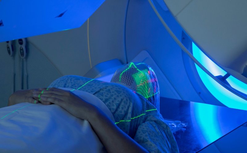 Toate tipurile de servicii de radioterapie pentru pacienţii oncologici vor fi decontate