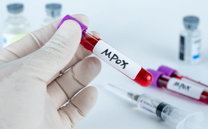 Un nou caz de infecție în Europa cu noua variantă de mpox, mai contagioasă și mai severă