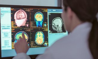 Un virus cu care mulți oameni vin în contact încă din copilărie ar putea declanşa boala Alzheimer