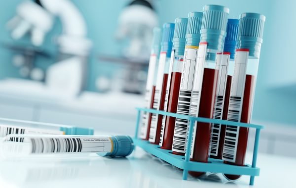 Vești bune! Un nou test de sânge pentru detectarea precoce a cancerului, validat cu succes în studiile clinice