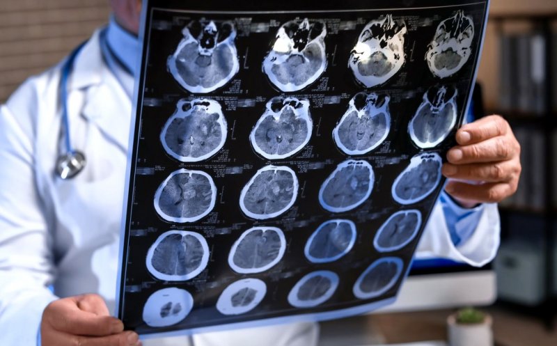 Antibioticele, antiviralele şi vaccinurile ar putea fi folosite pentru a combate demenţa