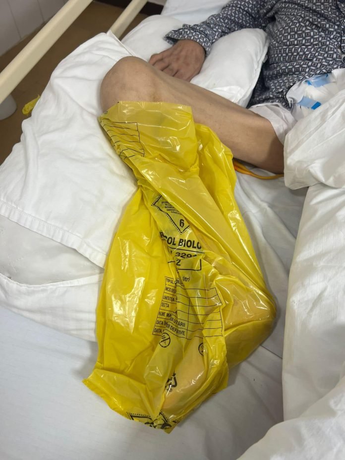 Pacient „tratat” la picior cu o pungă de gunoi la o secţie de infecţioase