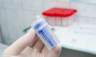Ce este calprotectina și care este rolul ei în organism?