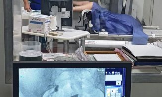Procedură medicală în premieră, la SCJU Cluj, pentru diagnosticarea infertilității sau a altor afecțiuni ale uterului și trompelor uterine