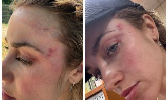 Scandal în Parcul Rozelor din Cluj: O mămică susține că a fost agresată de un bărbat, chiar în fața fiicei sale: "A început să mă lovească"