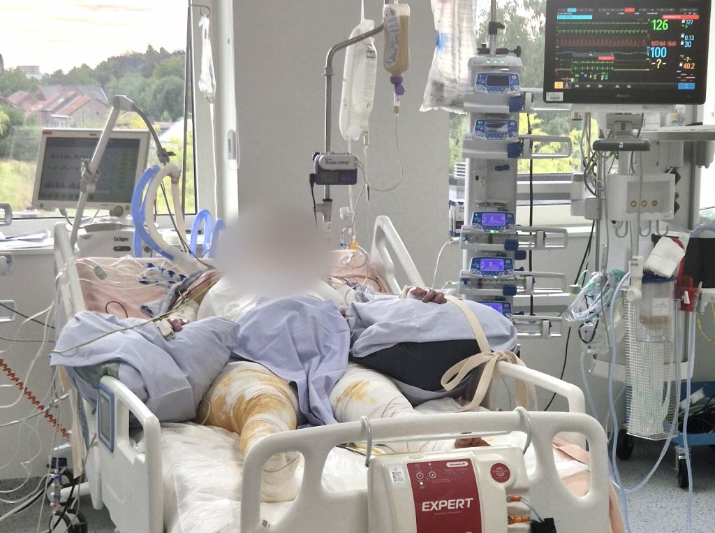 Sora pacientei infectată cu CANDIDA AURIS la Floreasca, mesaj pentru Zidaru: Nu vreți domnule manager să vedeți care dintre angajați au refuzat categoric să respecte dreptul la viață al unui pacient? Cum se făcea economie de mănuși sau măști