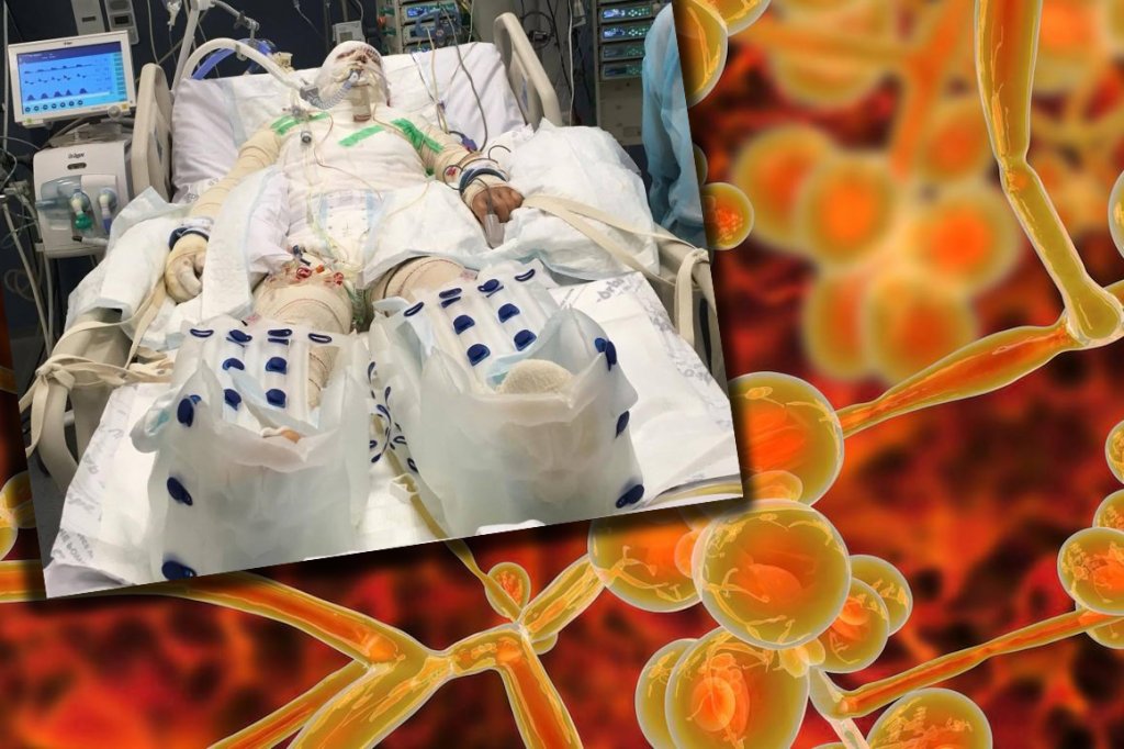 ALERTĂ sanitară în spitalele din Europa pentru CANDIDA AURIS, bacteria pe care multe spitale din România adesea se feresc să o raporteze, în loc să o combată