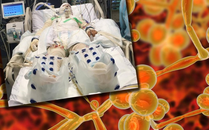 ALERTĂ sanitară în spitalele din Europa pentru CANDIDA AURIS, bacteria care multe spitale din România adesea se feresc să o raporteze, în loc să o combată