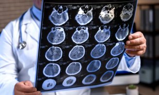 Medici de renume mondial vin la Cluj la cel de-al 50-lea Congres al Societăţii Române de Neurochirurgie