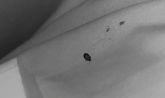 Ciuruită de ploșnițe la cușeta CFR Călători pe ruta București - Sighet / 13 ore în ”trenul groazei ”, la 190 de lei