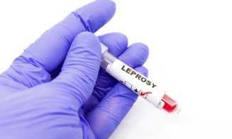 Reapare lepra în Europa? Croația confirmă un caz, România are deja două, ambele la Cluj