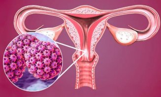 Testare GRATUITĂ la domiciliu pentru cancer de col uterin. Se face la Cluj