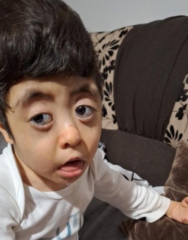 Salvează o inimă! Adelin are 6 ani și se luptă pentru fiecare respirație. Operația care-i poate salva viața costă 10.000 de euro