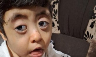 Salvează o inimă! Adelin are 6 ani și se luptă pentru fiecare respirație. Operația care-i poate salva viața costă 10.000 de euro