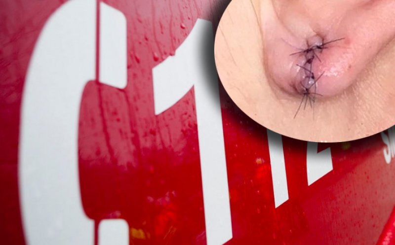 Tâlhărie în Cluj-Napoca, de 8 martie, în plină zi: I-a smuls unei femei cerceii de aur cu tot cu lobii urechilor