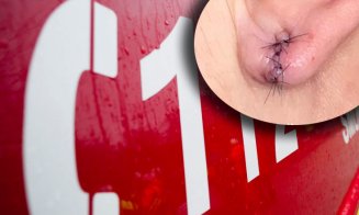 Tâlhărie în Cluj-Napoca, de 8 martie, în plină zi: I-a smuls unei femei cerceii de aur cu tot cu lobii urechilor