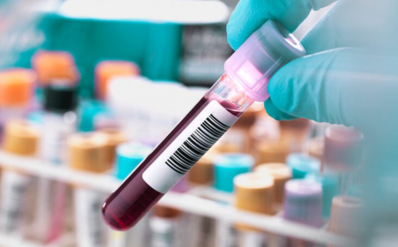 O anumită grupă sanguină pare să prezinte un risc mai mare de diabet de tip 2