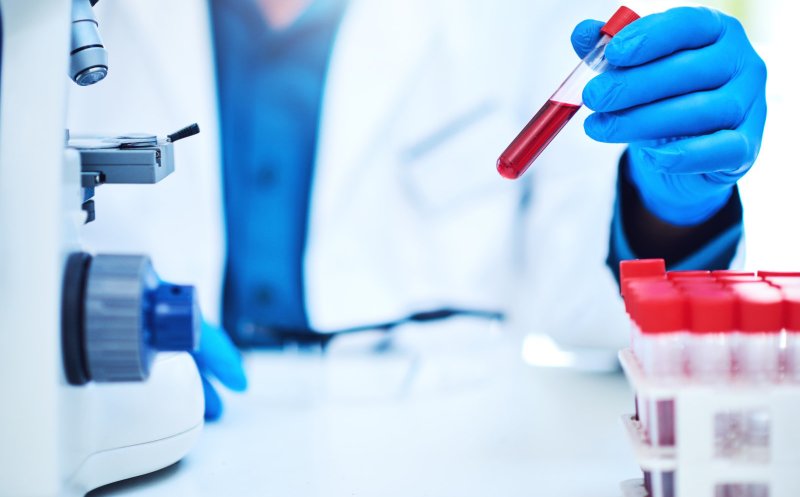 O proteină din sânge ar putea prezice demența cu zeci de ani înainte de diagnosticare