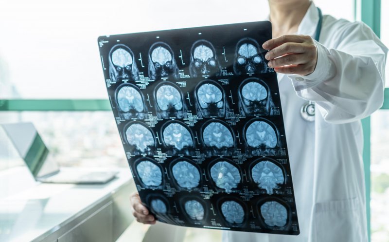 Avans în lupta cu Alzheimer. Israelul a dezvoltat o tehnologie care detectează boala cu ani înainte de primele simptome