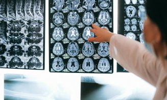 Descoperire uriașă în lupta cu Alzheimer. O proteină ar putea opri și chiar inversa afectarea creierului