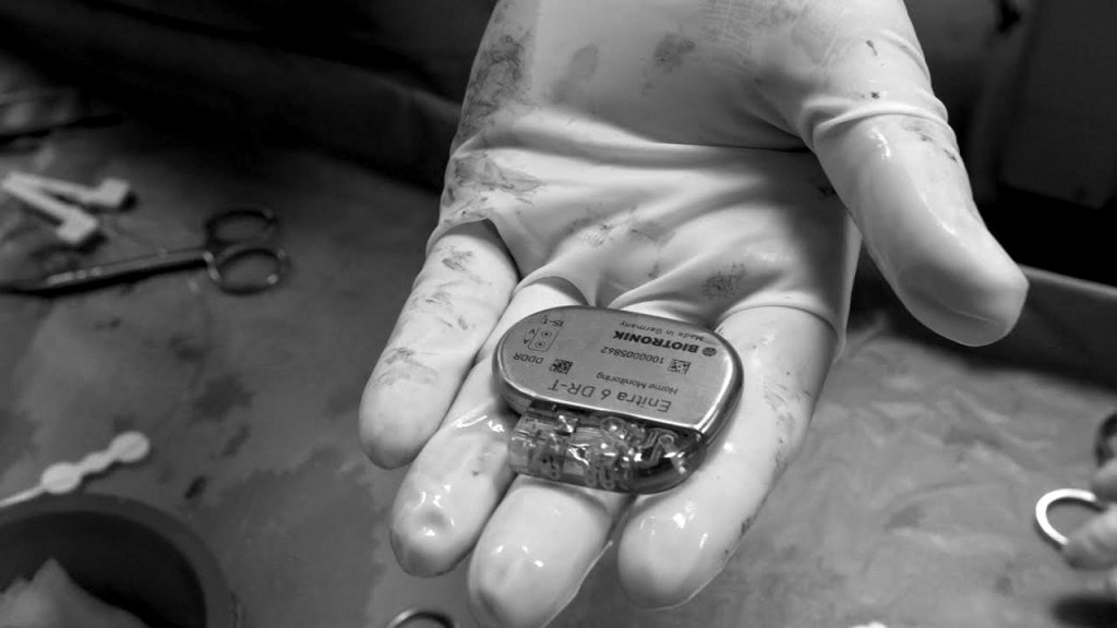Cardiologi trimiși în judecată pentru că au implantat pacienților stimulatoare cardiace extrase de la cadavre