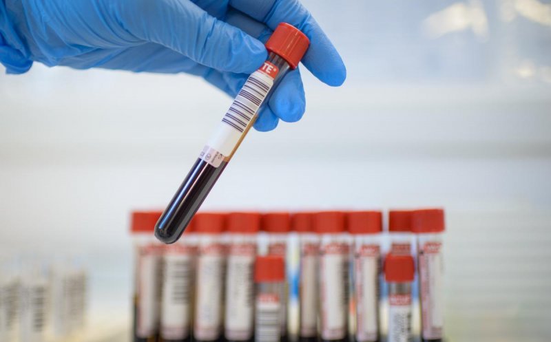 Analize medicale gratuite, fără goana de la începutul lunii: CNAS pregătește eliminarea plafoanelor