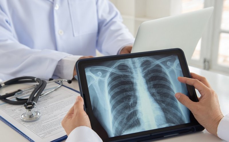 Cancerul pulmonar, terapiile biologice și AI, în centrul unei conferințe de pneumologie la Cluj
