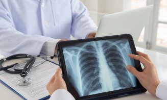 Cancerul pulmonar, terapiile biologice și AI, în centrul unei conferințe medicale la Cluj